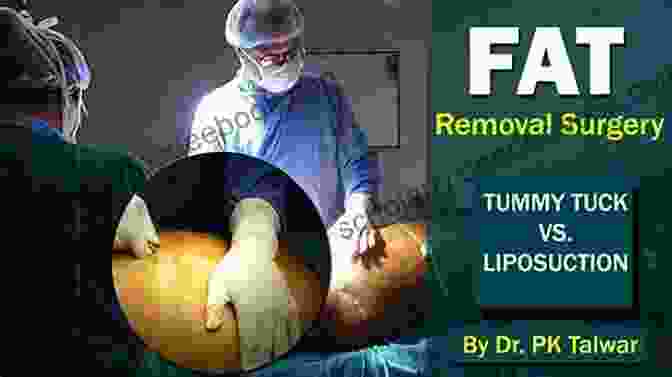 Patient Undergoing A Tummy Tuck Procedure To Remove Excess Skin And Fat From The Abdomen Body By Ferrari: How To Get The Best Results From Your Body Contouring Procedures