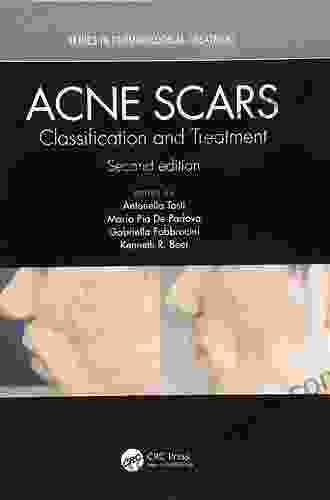 Acne Scars: Classification And Treatment (Series In Dermatological Treatment 6)
