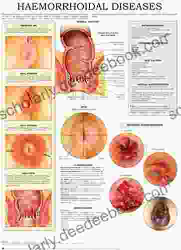 Haemorrhoidal Diseases E Chart: Quick Reference Guide