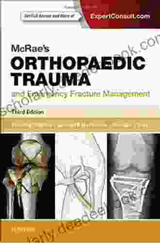 McRae S Orthopaedic Trauma And Emergency Fracture Management (Churchill Pocketbooks)