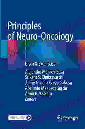 Principles Of Neuro Oncology: Brain Skull Base
